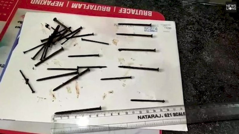 Dokter Keluarkan 116 Paku dari Perut Pria Ini