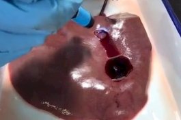 Lem Ajaib ini Bisa Menutup Luka Fatal di Organ Dalam Hitungan Detik