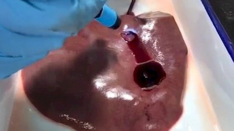 Foto: Universitas Kedokteran Zhejiang