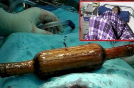 Istri Mandul, Suami Masukkan Alu Lewat Anus