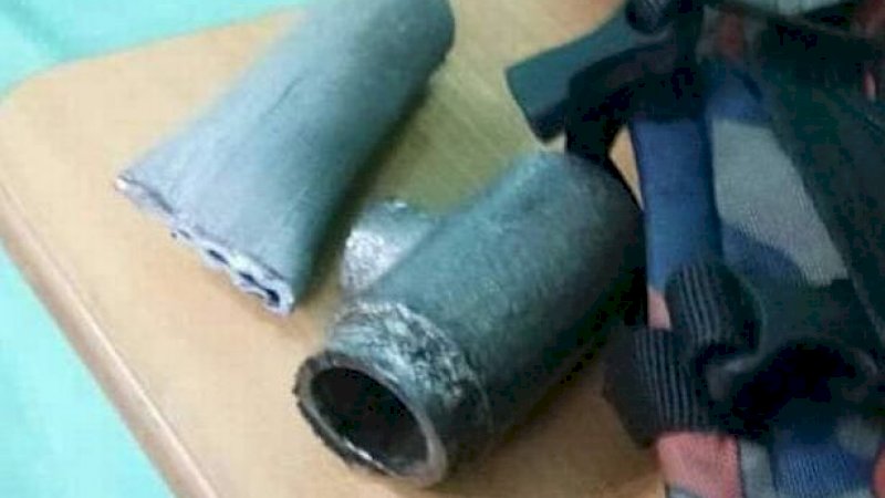 Kemaluannya Membengkak, Remaja Ini Tak Bisa Lepas dari Pipa Toilet