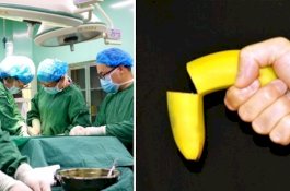 Istri Tunggu Suami Genitnya Tertidur, Lalu Potong 