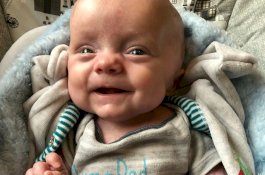 Lahir Tanpa Kulit, Bayi ini Secara Ajaib Berhasil Bertahan Hidup