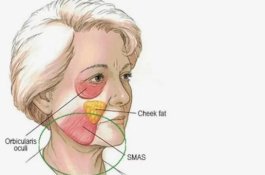 Lakukan Ini untuk Perbaiki Rahang Kendur Tanpa Operasi