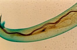 Hawaii Waspada Infeksi Cacing Otak