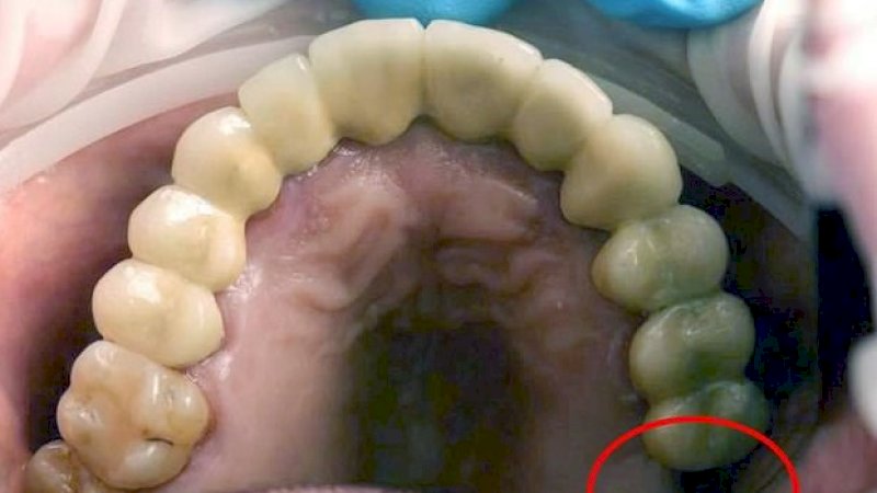 Foto: Rumah Sakit Anak Morozov