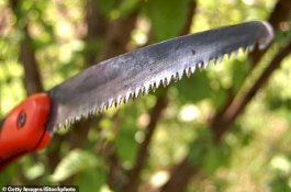 Sadis! Pria Aborigin Gergaji Pacarnya, Lalu Perkosa Sampai Mati Kehabisan Darah