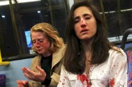 Pramugari dan Pasangan Lesbinya, Dipukul karena Tolak Berciuman