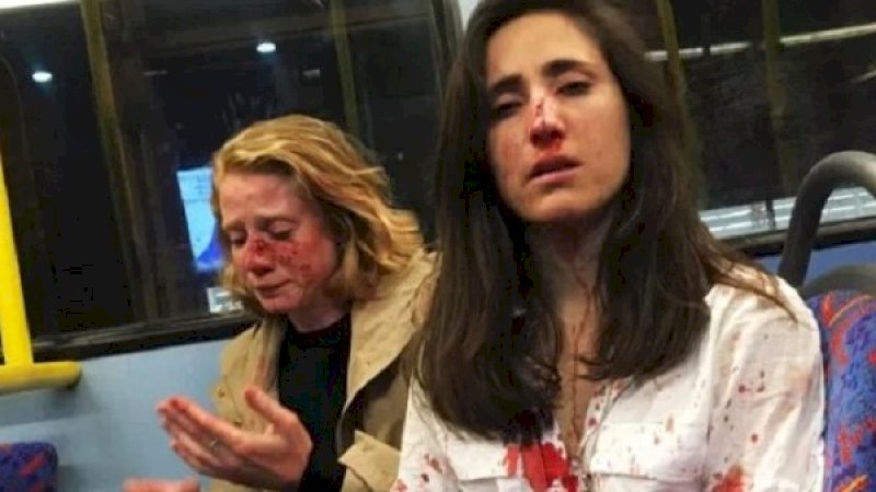 Chris dan Melania Geymonat usai dipukuli.