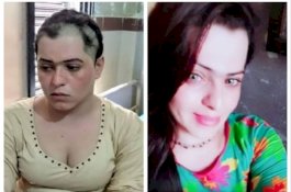 Tak Bayar Uang Keamanan, Penari Transgender Ini Diculik dan Digunduli