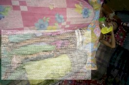 Tak Ada Biaya, Bocah Korban Petasan di Jeneponto Dirawat di Rumah