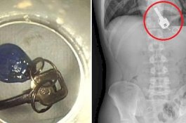 Pria Mabuk Ini Cari Kunci Rumah, Ternyata Dia Tak Sadar Menelannya