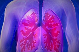 Apa Itu Bronkiektasis: Penyebab, Gejala, dan Pencegahannya