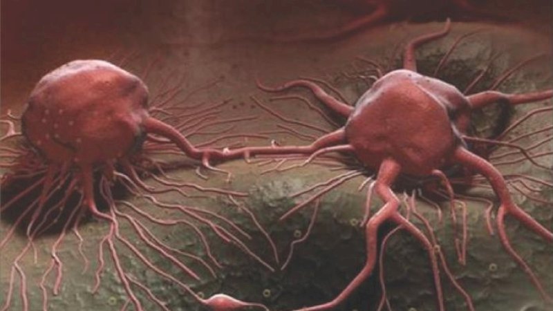 Ilustrasi sel kanker