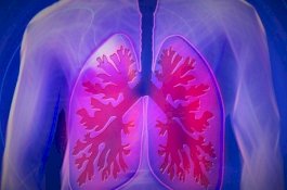 Gejala Kanker Paru-paru yang Harus Diketahui