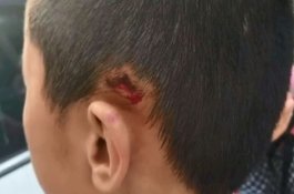 Guru SD Dipecat Setelah Menyeret dan Menghempaskan Siswanya ke Lantai