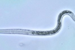 10 Tahun Sakit Perut, Ternyata Hewan 30 Cm Tinggal di Usus Wanita Ini