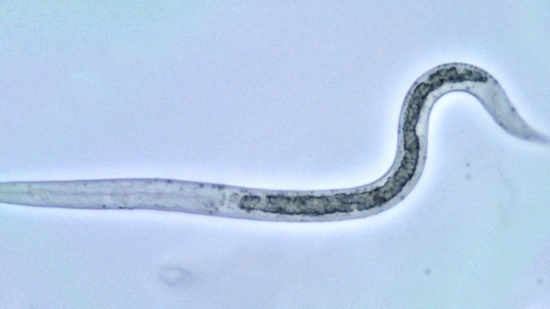 10 Tahun Sakit Perut, Ternyata Hewan 30 Cm Tinggal di Usus Wanita Ini