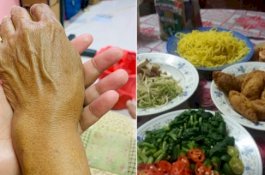 Meski Tangan Patah, Ibu Tetap Memasak untuk Lebaran, Sayang Kerabat Membatalkan di Menit Terakhir