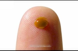 Golongan Darah Paling Langka: Darah Emas