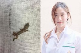 Pertama Kali Kerja, Dokter Cantik Ini Temukan Tokek di Telinga Pasien