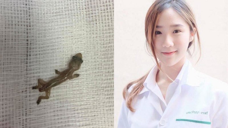 Pertama Kali Kerja, Dokter Cantik Ini Temukan Tokek di Telinga Pasien