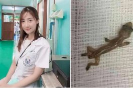 Dokter Cantik Kaget Lihat Cicak Merayap di Dalam Telinga Pasiennya