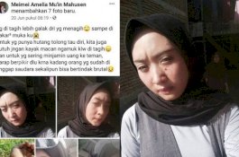 Tagih Utang, Wanita Ini Justru Dicakar Sahabatnya