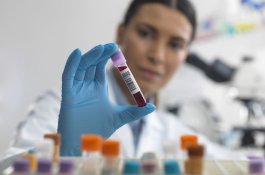 Ternyata Bisa Deteksi Penyakit 5 Tahun Lebih Awal Lewat Tes Urin