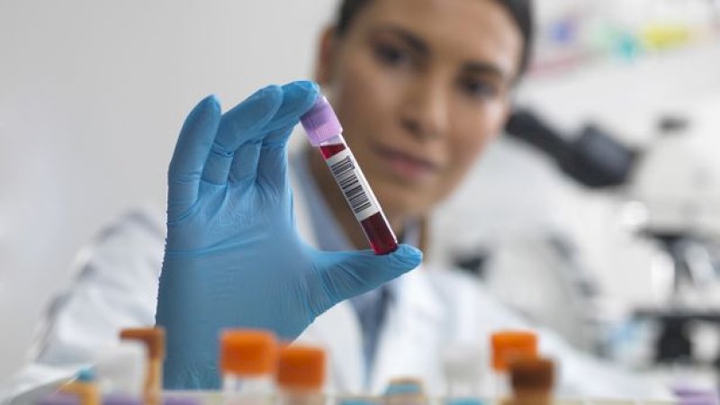 Ternyata Bisa Deteksi Penyakit 5 Tahun Lebih Awal Lewat Tes Urin