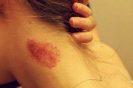 Wanita Ini Tewas karena Dicupang Suami, Kenali Bahayanya