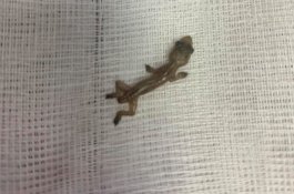 Dokter Thailand Temukan Tokek Hidup di Telinga Pasien