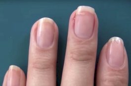 Aduh, Kuku Robek! Dengan Trik Aneh Ini Anda Bisa Memperbaikinya dalam Waktu Singkat