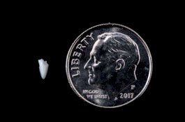 Ada Benjolan, Pria Ini Baru Sadar Ternyata Gigi Hiu Tertinggal di Kaki Selama 24 Tahun