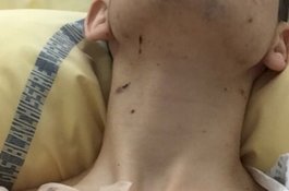 Saat Gali Harta Karun, Bom PD I Meledak dan Mengenai Pemuda ini