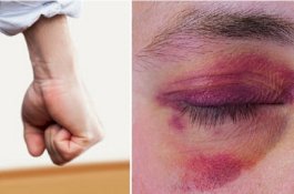 Cemburu Lihat Suaminya Lirik Perempuan Lain, Wanita Ini Justru Dianiaya