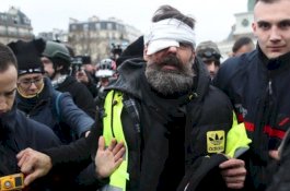 Protes Yellow Vest di Prancis: 24 Orang Kehilangan Mata