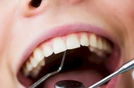 Makan Yoghurt Ternyata Bisa Cegah Gigi Berlubang