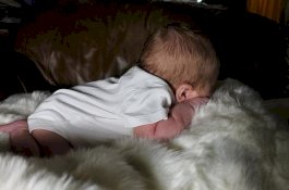 Kasian, Penis Bayi 1 Bulan ini Terpaksa Harus Diamputasi