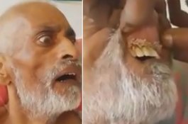 Ada Belatung di Gusi Pria Ini, Keluarga Gugat Rumah Sakit