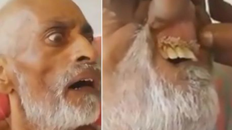 Ada Belatung di Gusi Pria Ini, Keluarga Gugat Rumah Sakit