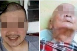 24 Jam Setelah Ayahnya Meninggal, Anak Tunggal Ini Ikut Berpulang
