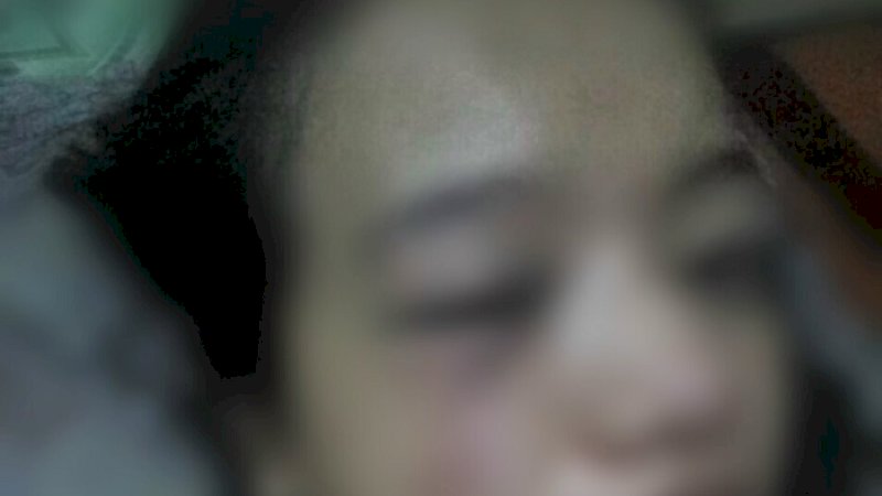 Korban yang berinisial ID.