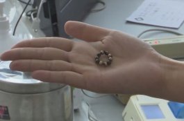 Usus Bolong Usai Telan 10 Bola Magnetik, Balita Ini Mengerang Kesakitan