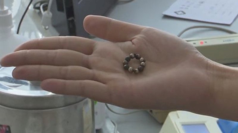 Usus Bolong Usai Telan 10 Bola Magnetik, Balita Ini Mengerang Kesakitan