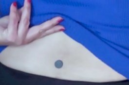 Alat Operasi Tertinggal Tubuh, Wanita Ini Bisa Tempelkan Magnet di Punggungnya