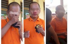 Gara-gara Bertanya, Kepala Sekolah di Pangkep Aniaya Guru hingga Berlumur Darah