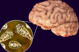 Usai Berenang di Danau, Pria Ini Terserang Infeksi Amuba 'Pemakan Otak'