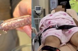 Wanita Potong Penis dan Testis Mantan Suami Lalu Memerahnya Setelah Dia Selingkuh