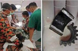 Alat Kelaminnya Terjebak di Gir Sepeda, Pria Ini Telepon Pemadam